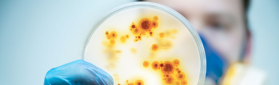 微生物分析